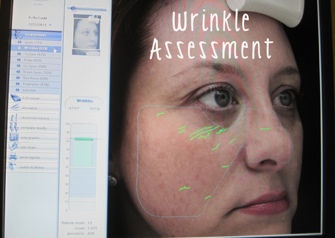 DermaPen, anti-aging, non-invasive